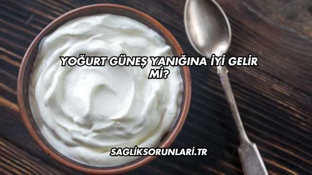 Yoğurt Güneş Yanığına İyi Gelir mi