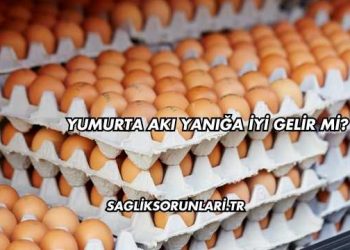 Yumurta Akı Yanığa İyi Gelir mi?