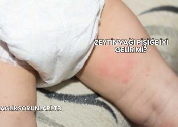 Zeytinyağı Pişiğe İyi Gelir mi?