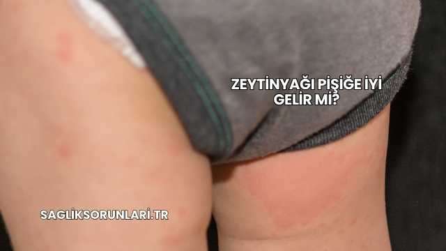 Zeytinyağı Pişiğe İyi Gelir mi?