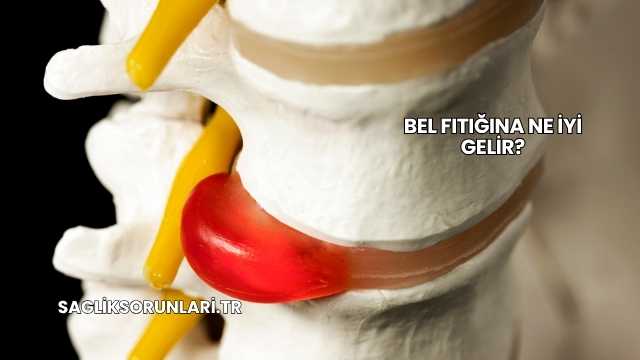 Bel Fıtığına Ne İyi Gelir?