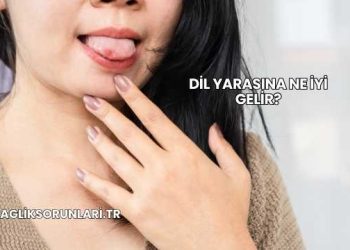 Dil Yarasına Ne İyi Gelir?