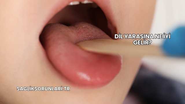 Dil Yarasına Ne İyi Gelir?