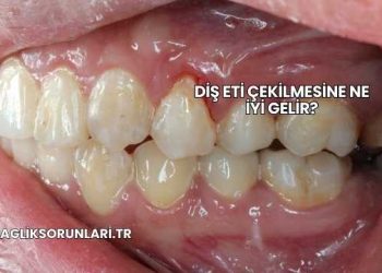 Diş Eti Çekilmesine Ne İyi Gelir?