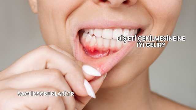 Diş Eti Çekilmesine Ne İyi Gelir?