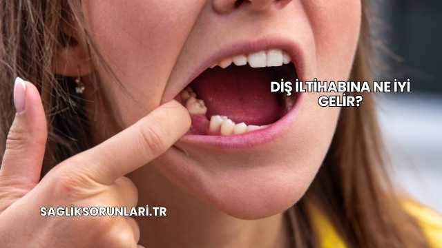 Diş İltihabına Ne İyi Gelir?
