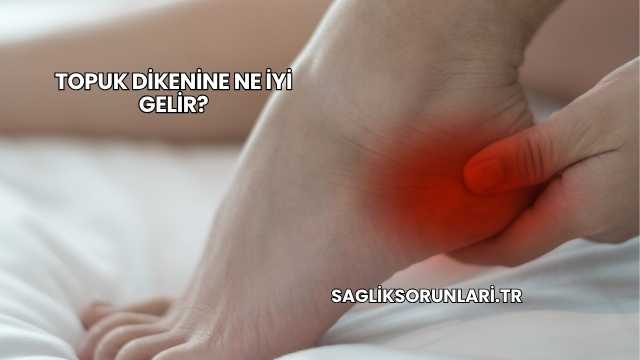 Topuk Dikenine Ne İyi Gelir?