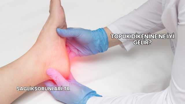 Topuk Dikenine Ne İyi Gelir?