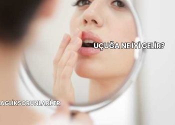 Uçuğa Ne İyi Gelir?