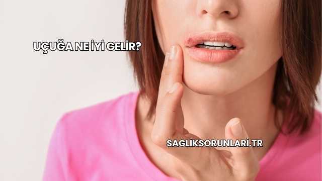 Uçuğa Ne İyi Gelir?