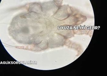 Uyuza Ne İyi Gelir?