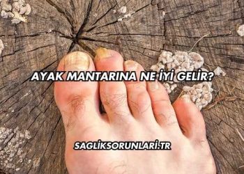 Ayak Mantarına Ne İyi Gelir?