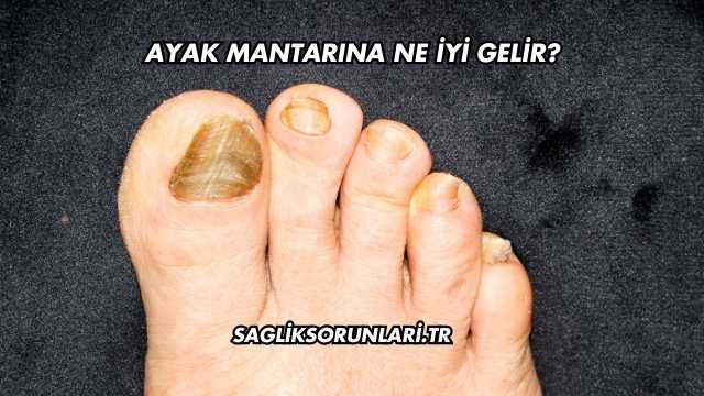 Ayak Mantarına Ne İyi Gelir?