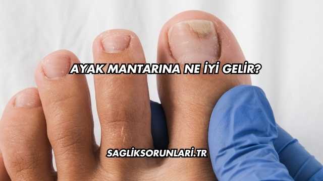 Ayak Mantarına Ne İyi Gelir?