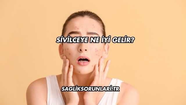 Sivilceye Ne İyi Gelir?