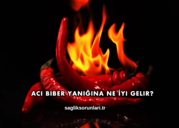 Acı Biber Yanığına Ne İyi Gelir?