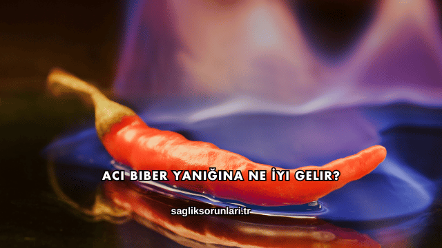 Acı Biber Yanığına Ne İyi Gelir?