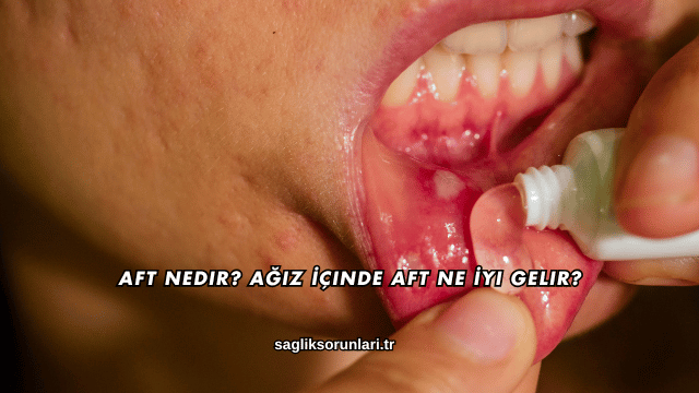Aft Nedir? Ağız İçinde Aft Ne İyi Gelir?