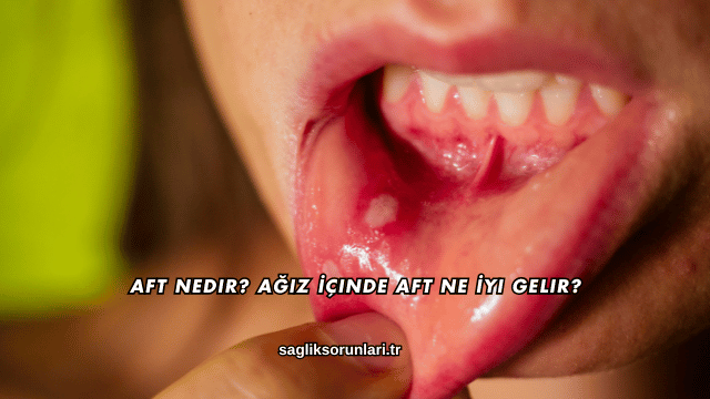 Aft Nedir? Ağız İçinde Aft Ne İyi Gelir?