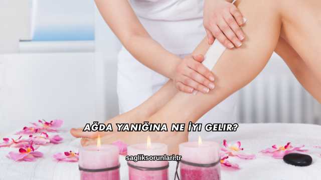 Ağda Yanığına Ne İyi Gelir?