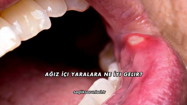 Ağız İçi Yaralara Ne İyi Gelir?