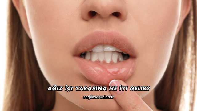 Ağız İçi Yarasına Ne İyi Gelir?