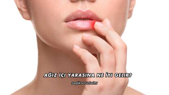 Ağız İçi Yarasına Ne İyi Gelir?