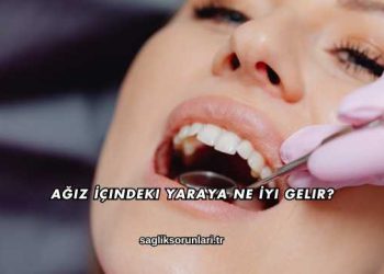 Ağız İçindeki Yaraya Ne İyi Gelir?