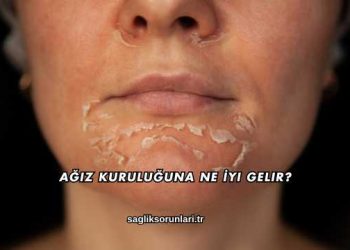 Ağız Kuruluğuna Ne İyi Gelir?