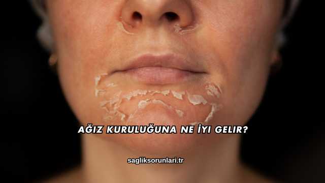 Ağız Kuruluğuna Ne İyi Gelir?