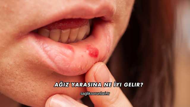 Ağız Yarasına Ne İyi Gelir?