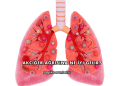 Akciğer Ağrısına Ne İyi Gelir?