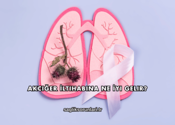 Akciğer İltihabına Ne İyi Gelir?