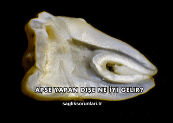 Apse Yapan Dişe Ne İyi Gelir?