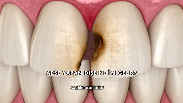 Apse Yapan Dişe Ne İyi Gelir?