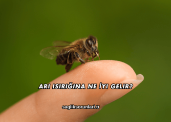 Arı Isırığına Ne İyi Gelir?