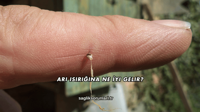 Arı Isırığına Ne İyi Gelir?