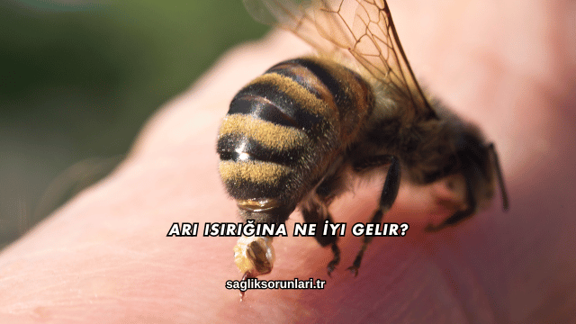 Arı Isırığına Ne İyi Gelir?