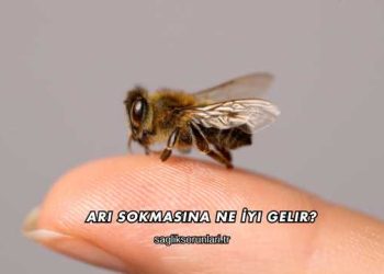 Arı Sokmasına Ne İyi Gelir?