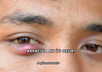 Arpacığa Ne İyi Gelir?