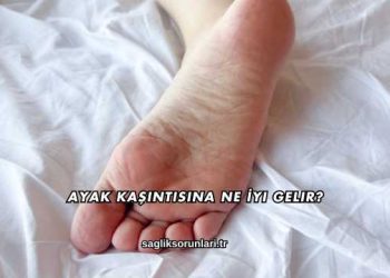 Ayak Kaşıntısına Ne İyi Gelir?