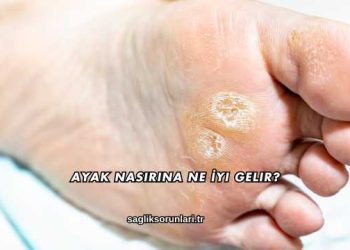 Ayak Nasırına Ne İyi Gelir?