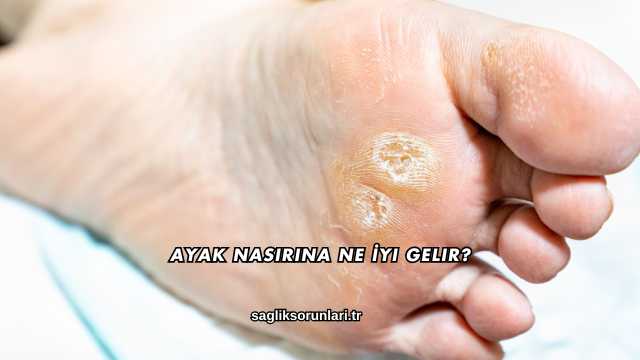 Ayak Nasırına Ne İyi Gelir?