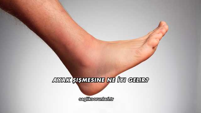 Ayak Şişmesine Ne İyi Gelir?
