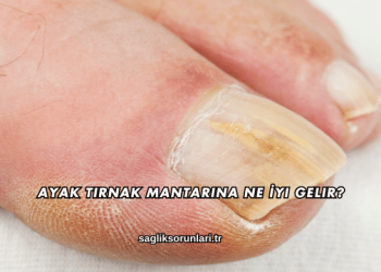 Ayak Tırnak Mantarına Ne İyi Gelir?