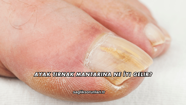 Ayak Tırnak Mantarına Ne İyi Gelir?