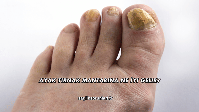 Ayak Tırnak Mantarına Ne İyi Gelir