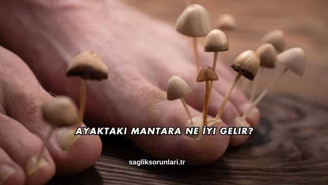 Ayaktaki Mantara Ne İyi Gelir?