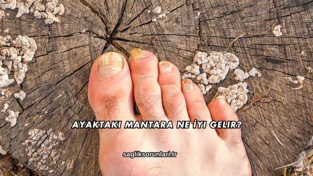 Ayaktaki Mantara Ne İyi Gelir?