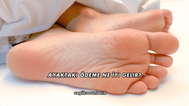 Ayaktaki Ödeme Ne İyi Gelir?